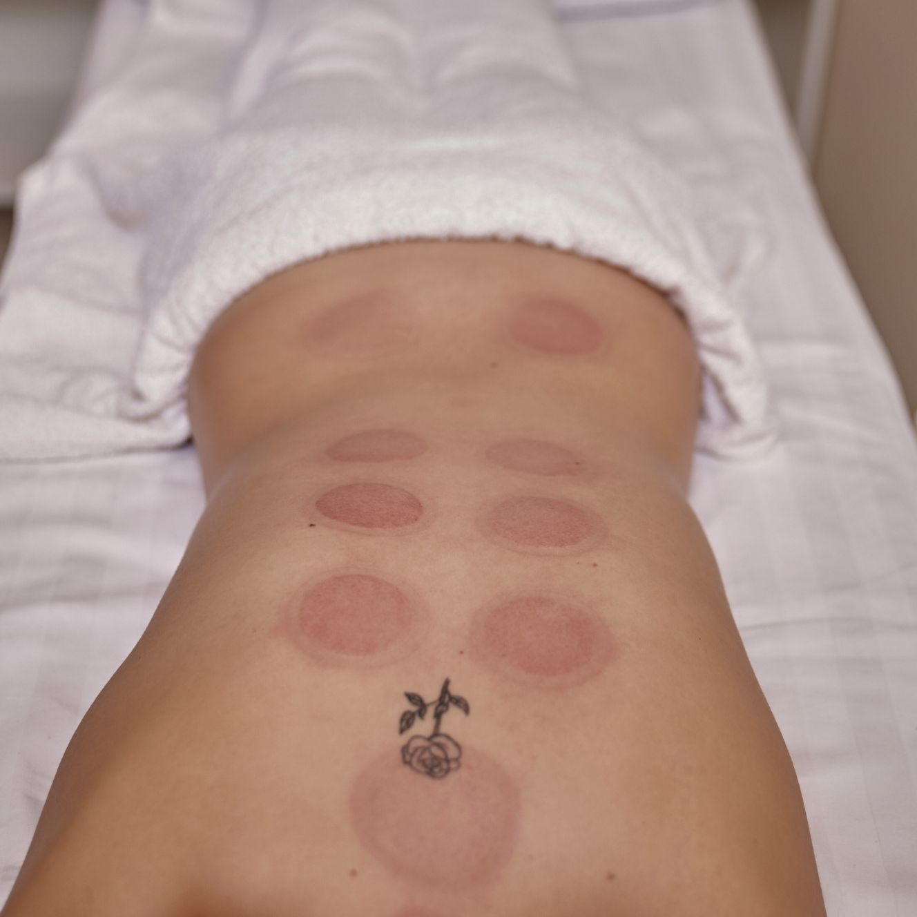Les ventouses - 拔罐 (báguàn) La thérapie par ventouses : une méthode ancestrale pour soulager et revitaliser La thérapie par ventouses, ou cupping therapy, est une pratique issue des traditions anciennes, notamment de la médecine traditionnelle chinoise. Elle consiste à appliquer des ventouses sur la peau afin de créer une légère aspiration. Cette technique stimule la circulation sanguine et énergétique, favorise l'élimination des toxines et libère les tensions musculaires. Les bienfaits des ventouses sont multiples : Soulagement des douleurs : efficace contre les tensions musculaires, les douleurs chroniques et les courbatures. Détoxification naturelle : améliore la circulation lymphatique et aide le corps à se purifier. Relaxation profonde : réduit le stress et favorise un bien-être général. Utilisées uniquement dans le cadre du bien-être, les ventouses s'adaptent à chaque individu et sont appliquées en douceur pour répondre à vos besoins spécifiques. Elles ne remplacent en aucune façon l'avis de votre médecin traitant, ostéopathe, kinésithérapeute. D'ailleurs, aucun diagnostic ne peut être posé! Seul votre médecin traitant est formé et habilité à faire un diagnostic et il est fortement conseillé de toujours demander l'avis de votre référent médical avant toute approche, quelle qu'elle soit. Les ventouses avec saignée quant à elles, sont strictement interdites en France. Cette technique est réservée aux professionnels de santé formés et autorisés. Donc pas de Hijama non plus.